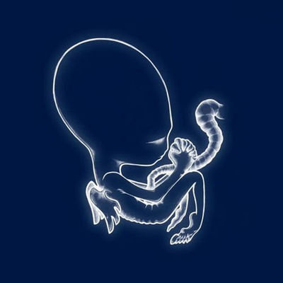 The cover of Ágætis byrjun by Sigur Rós
